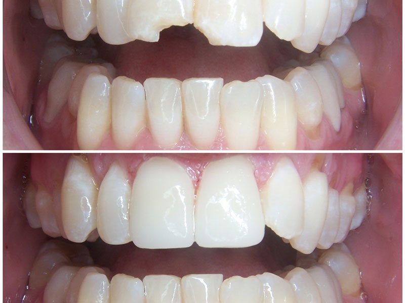 Dental treatment at Dr. Karen Davis Dentistry